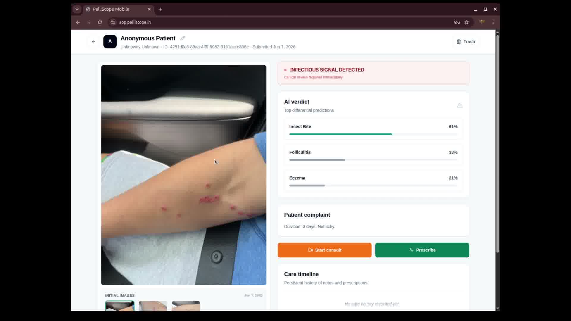 Clinician review screen with a patient case and care notes